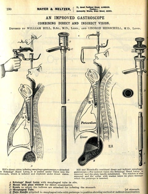 mayer-and-meltzer-gastroscope-c-1914a